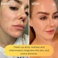 thumbnail image 3 of KOA LIFE Vit-C All Natural Brightening Cleanser , 30ML , Anti-Aging, Treats Hyperpigmentation, Brightens Skin, Evens Skin Tone , Natural, Doctor-Formulated, Vegan, Cruelty & Chemical Free, 3 of 7