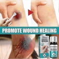 thumbnail image 3 of Medical Glue For Cuts, Fast-drying Breathable Liquid Skin Bandage, Great For Use On Fingers, 3 of 5