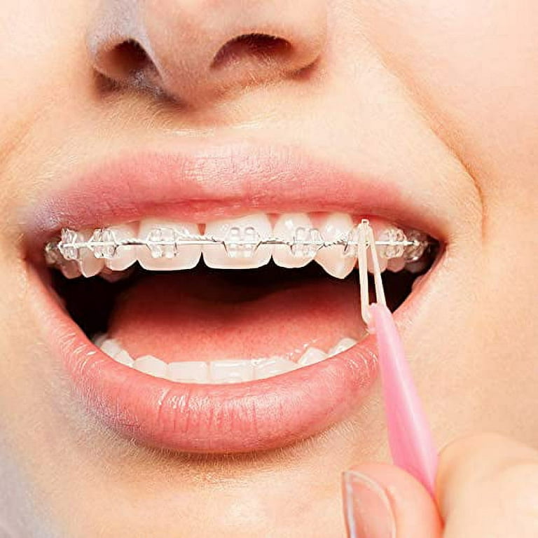  JMU Orthodontic Rubber Bands 1/8 Medium, 500 Pack Orthodontic  Elastics 4.5 oz, Neon Latex Free Dental Rubber Band for Braces : Health &  Household