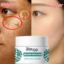 thumbnail image 5 of Crema iluminadora para el melasma con niacinamida de Eelhoe Crema iluminadora para reducir la melanina Suero para el cloasma Aclara las líneas finas del rostro, 5 of 5