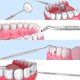 thumbnail image 3 of sistema de cuidado dental determinado de 8 piezas, instrumento del dentista del acero inoxidable, herramientas dentales, 3 of 5