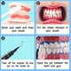 thumbnail image 3 of Tooth Gum Barrier Protective Gel, 10 Pack 3 Ml Gum Protective Gel For Teeth Whitening, 3 of 5