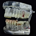 thumbnail image 3 of 14k Rose Gold Plated Drip Grillz Dripping Bottom Lower Teeth Melting Hip Hop Grills, 3 of 5