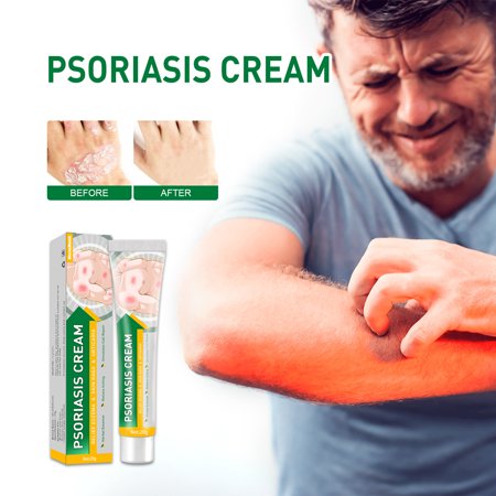 West & Month Antipruritic Cream, Skin Removal Topical Itching Mosquito Bites Itchy Hands and Feet Blister Antipruritic Balm