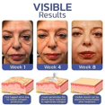 thumbnail image 5 of Invisible Double Eyelid Shaping Cream, Lifting Eyelid Defining Cream, Long Acting Double Eyelid Styling Beauty Cream For Women Men, 5 of 5