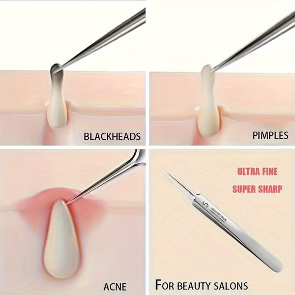 1/3pcs Professional Facial Blackhead Remover Tweezers, Acne Removal Kit, Pimple Popper Tool, Stainless Steel