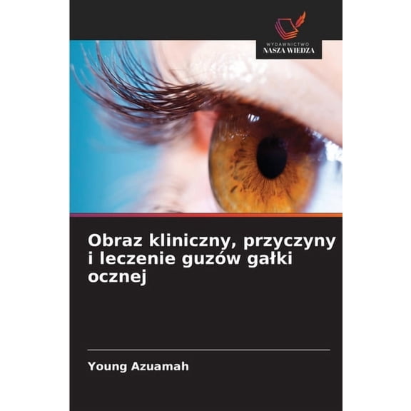 Obraz kliniczny, przyczyny i leczenie guzów galki ocznej, (Paperback)