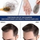thumbnail image 4 of Scalp Care Cream Scalp Deep Nutrition Dense Hair Repair Hair Follicle Restore Vitality Luster B, 4 of 4