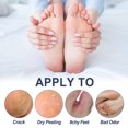 thumbnail image 3 of Foot Spray, Nourishing Heel Spray 2pcs 30ml Reduce Sweating Moisturizing Fast Absorption Dead Skin Removal  For Elderly For Dry Heels, 3 of 8