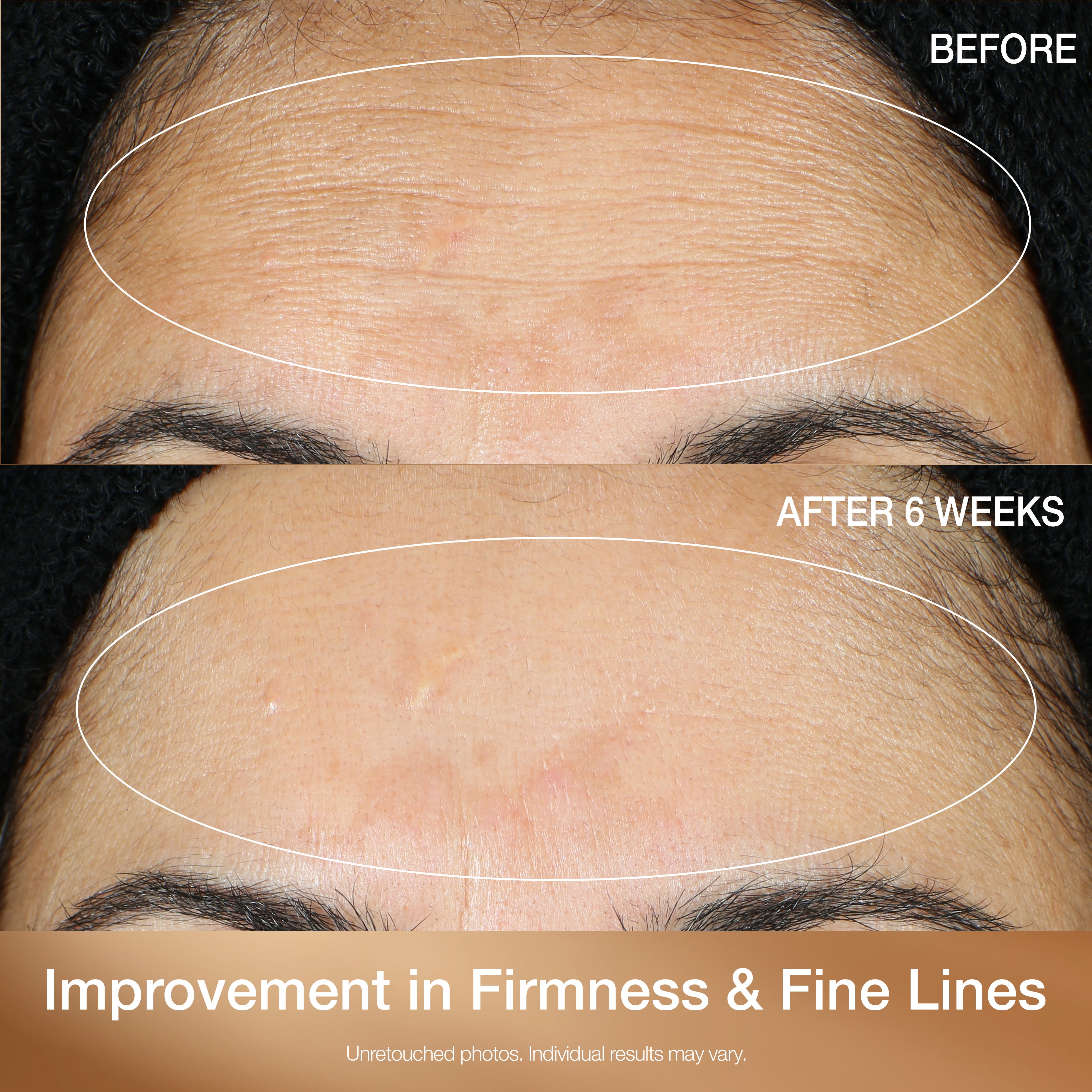 StriVectin Super-C Retinol Brighten & Correct Vitamin C Serum, 1 oz