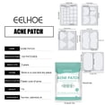 thumbnail image 3 of Acne Pimple Patches, 8 Sizes 102 Patches For Large Zit Breakouts, Acne Patches For Face, Chin Or Body, Hydrocolloid Bandages Acne With Tea, 3 of 5