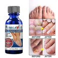 thumbnail image 5 of Nail Repair Solution for Fungal Growth. Nail care., 5 of 5