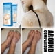 thumbnail image 3 of Crema Piebald para manchas blancas, ungüento para Vitiligo, crema para manchas de sudor a base de hierbas, cuidado de la piel corporal, 3 of 5