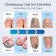 thumbnail image 3 of 2024 Nail Fungus Laser Treatment Device for Multiple Toenail, Home Use 905nm Infrared Light + 470nm Blue Light Toe Nail, 3 of 5