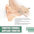 thumbnail image 3 of Tinnitus Ear Drops Relief Tinnitus External Cochlear Drops Ear Drops Relieve Ear Itching E, 3 of 3