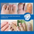 thumbnail image 4 of Nail Fungus Laser Device Light Therapy Effective Onychomycosis Toenails Treatment 470nm 910nm Home Use, 4 of 5
