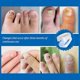 thumbnail image 4 of Nail Fungus Laser Device Light Therapy Effective Onychomycosis Toenails Treatment 470nm 910nm Home Use, 4 of 5