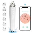 thumbnail image 1 of Aspiradora de poros para eliminar puntos negros [Certificación FDA] Limpiador de poros facial visible WiFi con cámara HD Kit extractor de comedones y acné con 6 cabezales de succión Herramienta eléctr, 1 of 5