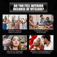 thumbnail image 5 of 2x Vitiligo Skin Repair Spray For Skin Care, Repair Skin, Vitiligo Care Spray for Reduce White Spots, 5 of 5