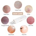 thumbnail image 4 of Espátula de piel, limpiador de poros, herramienta de elevación de belleza, extractor de 4 modos, espátula de limpieza facial Afortunado Sencillez, 4 of 5