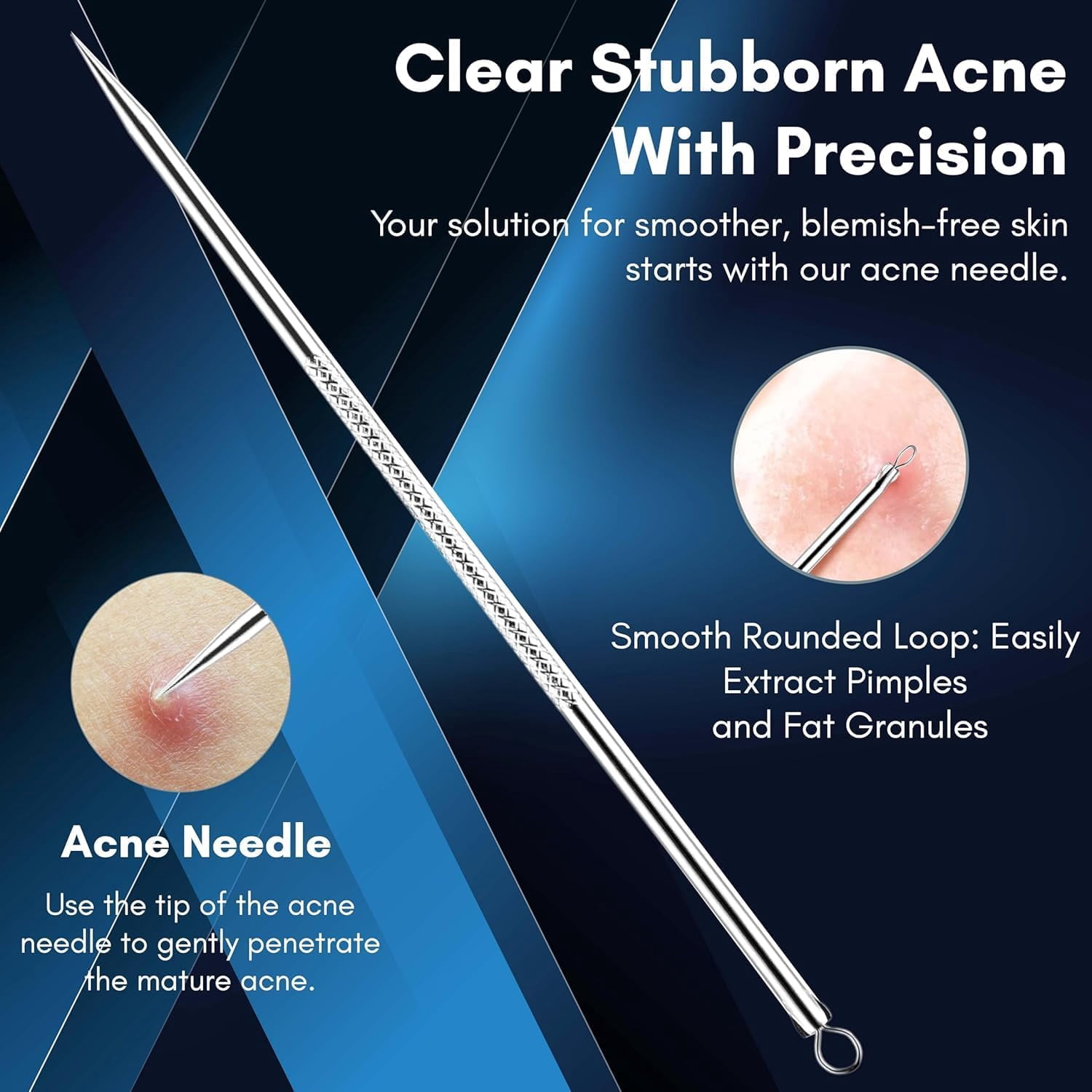 Basics Blackhead Acne Removal Needle Kit 4 Pcs Cleaning Tool Blemish Pimple Comedone for Women and Men
