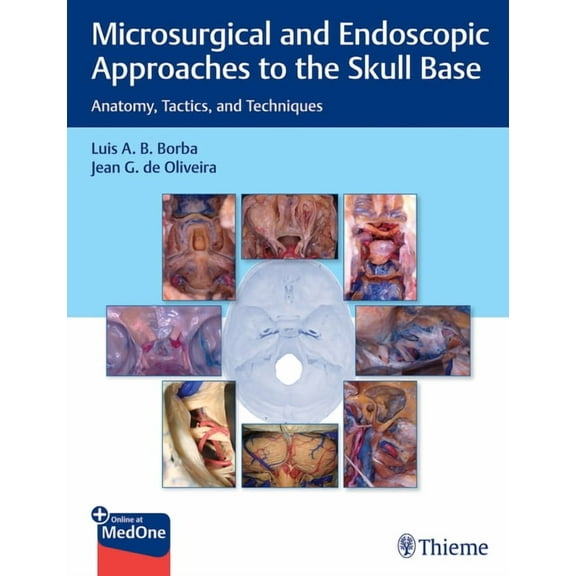 Microsurgical and Endoscopic Approaches to the Skull Base: Anatomy, Tactics, and Techniques (Hardcover)