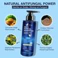 thumbnail image 2 of Champú antifúngico Uttse para la psoriasis del cuero cabelludo, 300 ml, 2 of 5