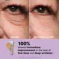 thumbnail image 4 of TikTok Exclusive: Eye Tightener - Tighten & Lift Eye Area Instantly ,Reduce Puffiness, 4 of 7