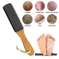 thumbnail image 4 of Callus Remover Foot Scrubber, Professional Pedicure Foot, 4 of 4