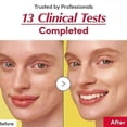thumbnail image 3 of Vitamin C Brightening Serum for Face - Hydrating, Glowing Skin, Dark Spot Corrector, Anti-Aging 30ml, 3 of 5