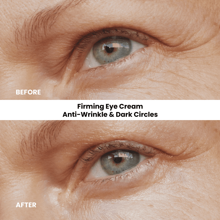Kleem Organics Anti-Aging Eye Cream, Reduces Eye Bags, Wrinkles