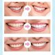 thumbnail image 5 of Bolígrafo blanqueador de dientes, agente blanqueador de dientes, limpiador de placa Dental, cuidado de higiene bucal, agente blanqueador de dientes, 5 of 5