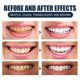thumbnail image 4 of 90g Tooth Whitening Powder Gums Protection Clean, 4 of 5