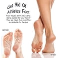 thumbnail image 4 of Electronics Shower Foot Massager Scrubber Cleaner for Shower Floor Improves Foot Circulation Remove Foot Dead Skin and Reduces Foot Pain, 4 of 6