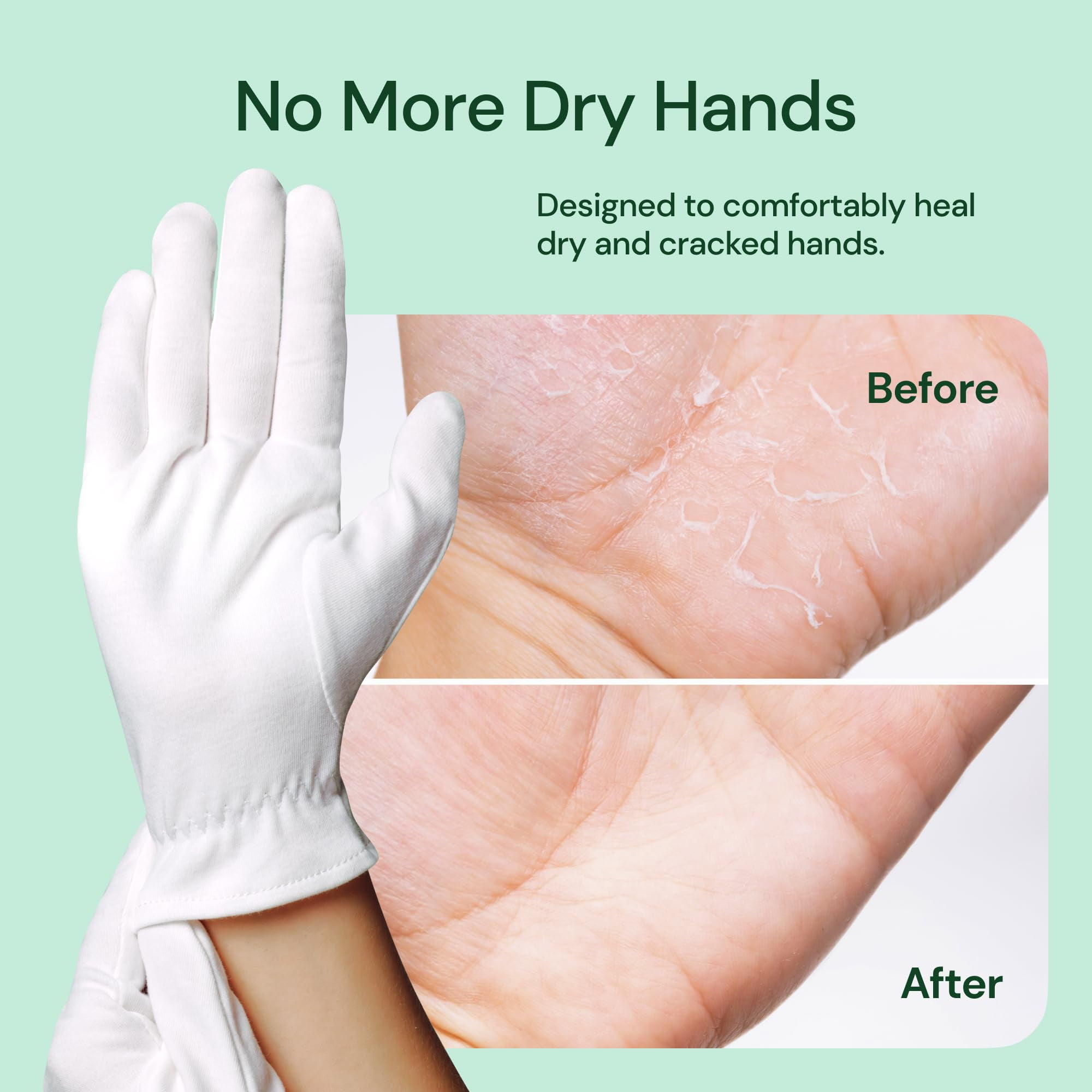 Extremely Dry Skin Vaseline And Gloves For Dry Hands Clearbody