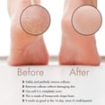 thumbnail image 4 of Professional Pedicure Foot File, Perfect Foot Care for Cracked Heels - Pedicure Tools, 4 of 6