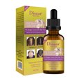 thumbnail image 1 of Aceite esencial para el cabello HUOGUO Ginger Essence para el crecimiento del cabello, 30 ml, 1 of 5