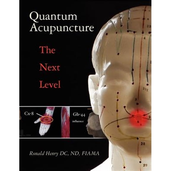Pre-Owned Quantum Acupuncture : The Next Level