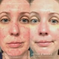 thumbnail image 2 of Set de cuidado de la piel Rodan + Fields Soothe Regimen para pieles sensibles, 2 of 6