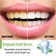 thumbnail image 3 of Suero dental desechable ANGGREK 20 piezas blanqueador de dientes, 3 of 8
