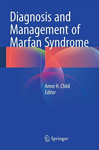 Diagnosis And Management Of Marfan Syndrome | Walmart Canada