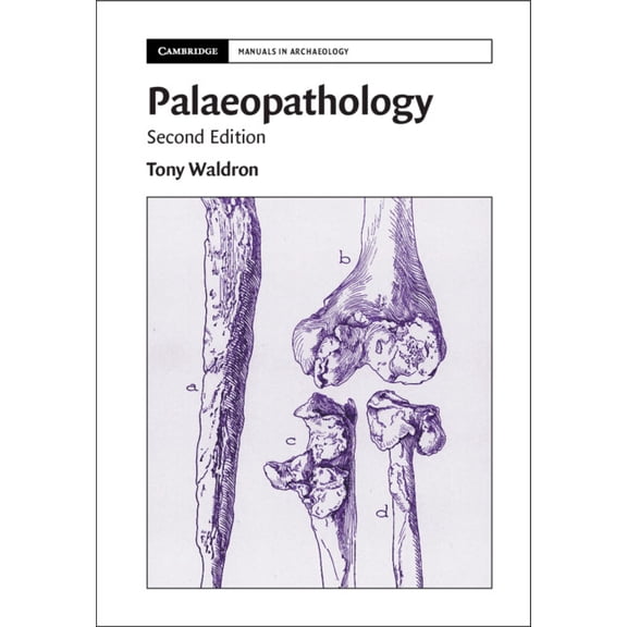Cambridge Manuals in Archaeology Palaeopathology, (Paperback)