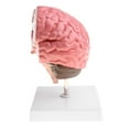 thumbnail image 3 of AMLESO Advanced Human Brain Cortex Pathology Model Anatomical Education Lab Display, 3 of 8