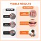 thumbnail image 4 of Tratamiento para morderse las uñas LCYATSI para niños y adultos (15 ml), 4 of 8
