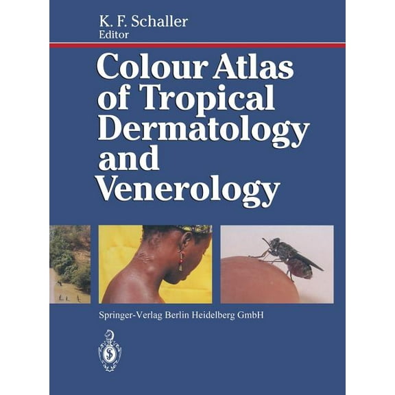 Colour Atlas of Tropical Dermatology and Venerology, (Paperback)