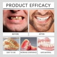 thumbnail image 4 of Suction-fit Complete Denture, Silicone Full Denture Set, Multifunctional silicone denture set, for Men and Women (1pcs) 1pcs, 4 of 5