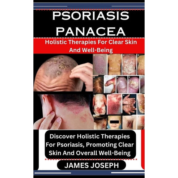 Psoriasis Panacea: Holistic Therapies For Clear Skin And Well-Being: Discover Holistic Therapies For Psoriasis, Promoting Clear Skin And Overall Well-Being (Paperback)