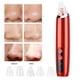 thumbnail image 5 of Máquina de limpieza de exportación de poros faciales,Máquina eléctrica de eliminación de espinillas Máquina de cuidado facial Máquina de exportación de poros faciales Estética elegante, 5 of 8