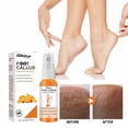 thumbnail image 1 of Cremas y lociones para manos, exfoliante para pies - 30 ml, potente - gel súper fuerte, efecto para pies y pies - productos para piel agrietada y muerta, 1 of 9