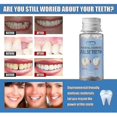 thumbnail image 2 of 3pcs Resin 30g Temporary Tooth Repair Kit Teeth And Gaps Falseteeth Solid Glue Denture Adhesive Teeth Whitening Tooth Beauty, 2 of 5